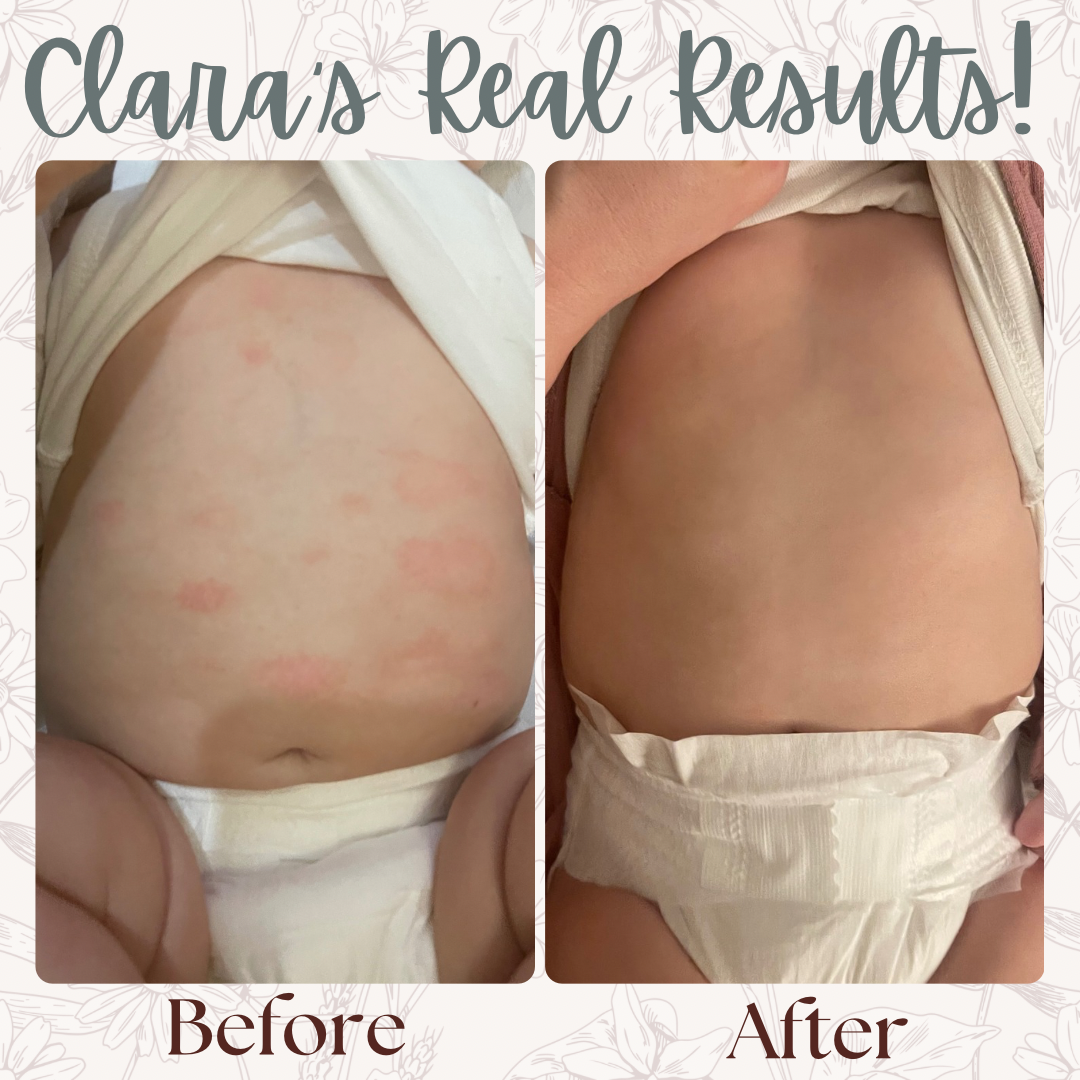 Clara's Comfort | Organic Eczema Balm for Babies & Sensitive Skin